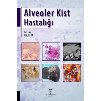 Alveoler Kist Hastalığı Ali KURT